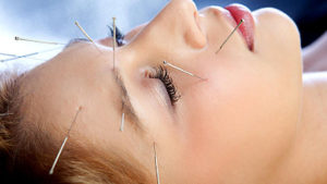 acupuncture treatment on face